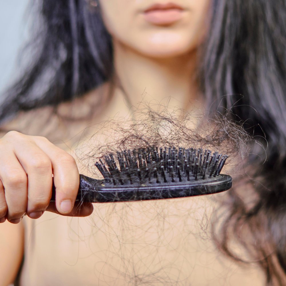 Hair Loss